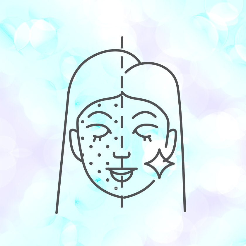 טיפול באקנה | פצעונים בפנים ובעור הגוף