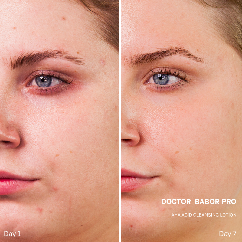 DOCTOR BABOR PRO תכשיר ניקוי אלפא הידרוקסי