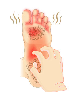 Clearance קרם אקטיבי לטיפול באקזמה ופטרת